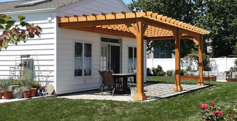 pergola kit